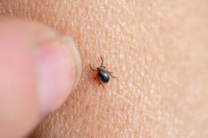Brown tick on a human skin.